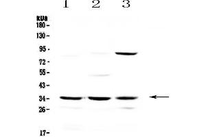 Western blot analysis of Alpha 1 microglobulin using anti-Alpha 1 microglobulin antibody .