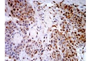 Immunohistochemistry (IHC) image for anti-Proteasome (Prosome, Macropain) 26S Subunit, ATPase, 3 (PSMC3) (AA 53-152) antibody (ABIN5542634)