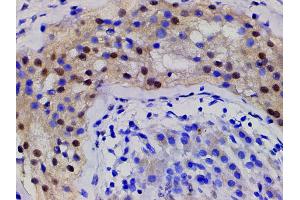 Immunohistochemistry (IHC) image for anti-Cofilin 1 (CFL1) (pSer3) antibody (ABIN6255180)