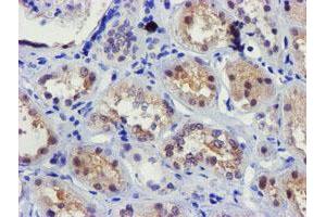Immunohistochemical staining of paraffin-embedded Human Kidney tissue using anti-FBXO21 mouse monoclonal antibody. (FBXO21 抗体)