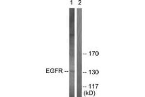 Western blot analysis of extracts from A431 cells, using EGFR (Ab-693) Antibody. (EGFR 抗体  (AA 661-710))