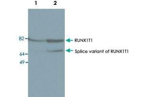 Western blot was performed on nuclear extracts from KAS-6/1 cells (human myeloma cell line, lane 1) and SKNO-1 cells (human acute myeloblastic leukaemia, lane 2) with RUNX1T1 polyclonal antibody , diluted 1 : 1,000 in TBS-Tween containing 5% skimmed milk. (RUNX1T1 抗体)