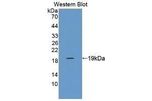 Detection of Recombinant MARCO, Rat using Polyclonal Antibody to Macrophage Receptor With Collagenous Structure (MARCO) (MARCO 抗体  (AA 367-519))