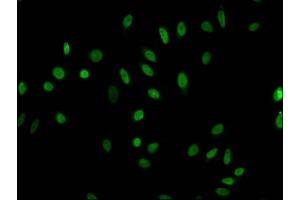 Immunofluorescent analysis of Hela cells (sodium butyrate, 30 mM, 4h) using ABIN7139191 at dilution of 1:100 and Alexa Fluor 488-congugated AffiniPure Goat Anti-Rabbit IgG(H+L) (HIST1H1E 抗体  (acLys63))