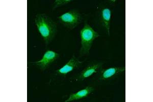 IF analysis of USP25 using anti-USP25 antibody (ABIN7598940). (USP25 抗体  (AA 1-1053))
