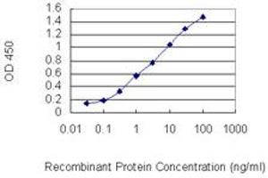 Detection limit for recombinant GST tagged IL15 is 0. (IL-15 抗体  (AA 30-129))