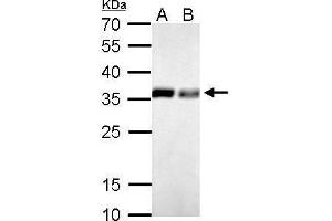 WB Image PPA1 antibody detects PPA1 protein by Western blot analysis. (Pyrophosphatase (Inorganic) 1 (PPA1) 抗体)