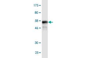 Western Blot detection against Immunogen (59. (PKD1L2 抗体  (AA 1-306))