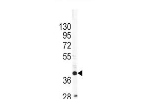 Western blot analysis of OL1 Antibody (C-term) 7361b in SK-Br-3 cell line lysates (35 μg/lane). (APOL1 抗体  (C-Term))