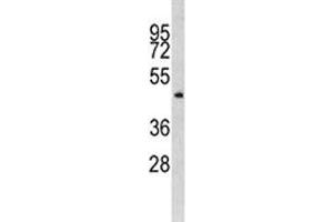 Western blot analysis of ILK antibody and MDA-MB435 lysate. (ILK 抗体  (AA 321-350))