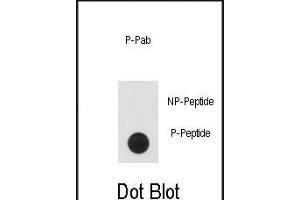 Dot blot analysis of anti-Phospho-CLASP1-p Antibody (ABIN6241038 and ABIN6578931) on nitrocellulose membrane. (CLASP1 抗体  (pThr656))