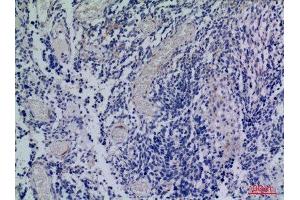 Immunohistochemistry (IHC) image for anti-Chemokine (C-X-C Motif) Receptor 3 (CXCR3) (Internal Region) antibody (ABIN6281636)