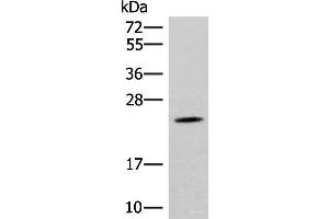 Western blot analysis of Mouse brain tissue lysate using TBPL1 Polyclonal Antibody at dilution of 1:400 (TBPL1 抗体)