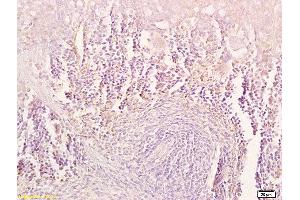 Immunohistochemistry (IHC) image for anti-Tumor Necrosis Factor (Ligand) Superfamily, Member 10 (TNFSF10) (AA 185-281) antibody (ABIN673494)
