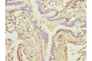 Immunohistochemistry of paraffin-embedded human lung tissue using ABIN7176151 at dilution of 1:100 (ZNF212 抗体  (AA 1-495))