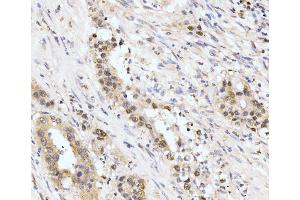 IHC analysis of AKAP 95/AKAP8 using anti-AKAP 95/AKAP8 antibody (ABIN7601553).