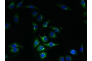 Immunofluorescent analysis of A549 cells using ABIN7150922 at dilution of 1:100 and Alexa Fluor 488-congugated AffiniPure Goat Anti-Rabbit IgG(H+L) (KIAA319L (AA 479-718) 抗体)