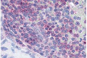 Human Spleen (formalin-fixed, paraffin-embedded) stained with XCR1 antibody ABIN213355 at 2. (XCR1 抗体  (Extracellular Domain))