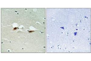 Immunohistochemical analysis of paraffin-embedded human brain tissue using ATF-2 (Phospho-Ser472) antibody (left)or the same antibody preincubated with blocking peptide (right). (ATF2 抗体  (pSer472))