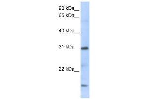 CXCL16 antibody used at 1 ug/ml to detect target protein. (CXCL16 抗体)