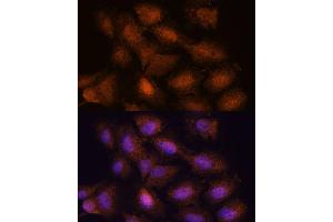 Immunofluorescence analysis of C6 cells using UPF3A antibody (ABIN7271227) at dilution of 1:100. (UPF3A 抗体  (AA 327-476))