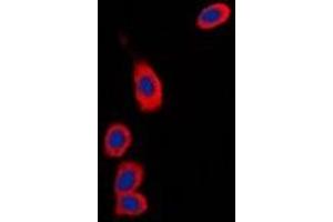 Immunofluorescent analysis of RPS6KC1 staining in Hela cells. (RPS6KC1 抗体)