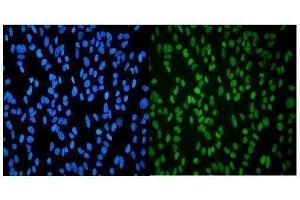 IF analysis of HP1 alpha/CBX5 using anti-HP1 alpha/CBX5 antibody (ABIN7599058).