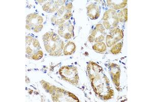 Immunohistochemistry of paraffin-embedded human gastric using PER1 antibody at dilution of 1:100 (x40 lens).