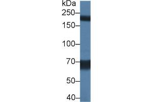Western Blotting (WB) image for anti-Transient Receptor Potential Cation Channel, Subfamily M, Member 7 (TRPM7) (AA 19-179) antibody (ABIN7436144)