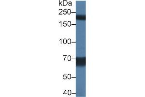 Detection of TRPM7 in Rat Serum using Polyclonal Antibody to Transient Receptor Potential Cation Channel Subfamily M, Member 7 (TRPM7) (TRPM7 抗体  (AA 19-179))