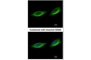 ICC/IF Image Immunofluorescence analysis of methanol-fixed HeLa, using TULP1, antibody at 1:500 dilution. (TULP1 抗体)
