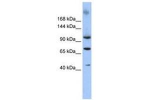 Image no. 1 for anti-Terminal Uridylyl Transferase 1, U6 SnRNA-Specific (TUT1) (AA 253-302) antibody (ABIN6740335) (TUT1 抗体  (AA 253-302))