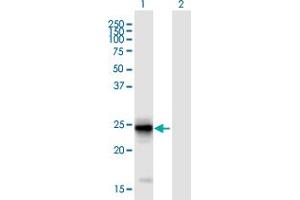 Western Blot analysis of FIBIN expression in transfected 293T cell line ( H00387758-T01 ) by FIBIN MaxPab polyclonal antibody. (FIBIN 抗体  (AA 1-211))
