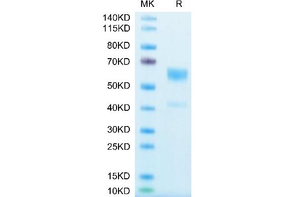 IL-9 Protein (AA 19-144) (Fc Tag)