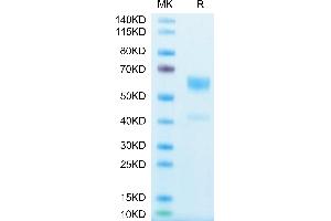 Human IL-9 on Tris-Bis PAGE under reduced condition. (IL-9 Protein (AA 19-144) (Fc Tag))