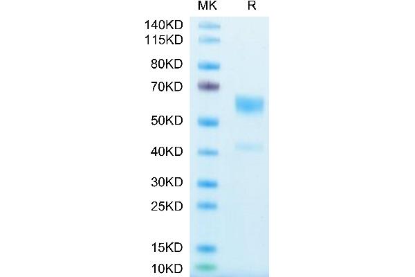IL-9 Protein (AA 19-144) (Fc Tag)