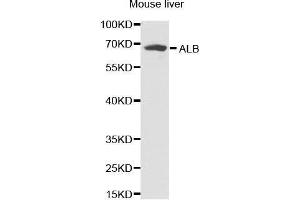 Western Blotting (WB) image for anti-Albumin (ALB) antibody (ABIN3021925) (Albumin 抗体)