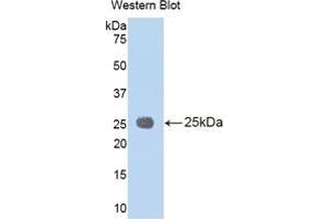WB of Protein Standard: different control antibodies  against Highly purified E. (IL1RAP ELISA 试剂盒)