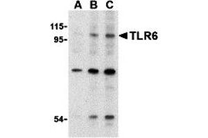 Western Blotting (WB) image for anti-Toll-Like Receptor 6 (TLR6) (N-Term) antibody (ABIN1031623) (TLR6 抗体  (N-Term))