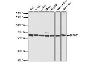Western Blotting (WB) image for anti-Sterol Regulatory Element Binding Transcription Factor 2 (SREBF2) (AA 1-220) antibody (ABIN6148430)