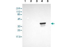 Western blot analysis of Lane 1: RT-4, Lane 2: EFO-21, Lane 3: A-431, Lane 4: Liver, Lane 5: Tonsil with OTC polyclonal antibody  at 1:250-1:500 dilution. (OTC 抗体  (AA 172-299))