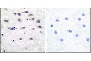 Immunohistochemistry analysis of paraffin-embedded human brain, using GluR1 (Phospho-Ser849) Antibody. (Glutamate Receptor 1 抗体  (pSer849))
