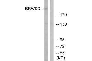 Western blot analysis of extracts from HuvEC, K562, Jurkat and HeLa cells, using HSPA8 antibody. (Hsc70 抗体  (Internal Region))