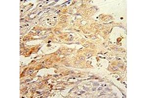 Immunohistochemistry (IHC) image for anti-PTEN Induced Putative Kinase 1 (PINK1) antibody (ABIN3028956)