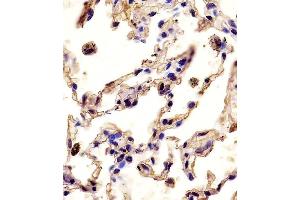 (ABIN390136 and ABIN2840640) staining P12 in human lung tissue sections by Iunohistochemistry (IHC-P - paraformaldehyde-fixed, paraffin-embedded sections). (MMP12 抗体  (C-Term))
