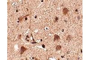 Immunohistochemistry (IHC) image for anti-SLIT and NTRK-Like Family, Member 5 (SLITRK5) (Middle Region 2) antibody (ABIN1031202) (SLITRK5 抗体  (Middle Region 2))