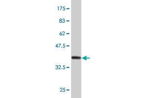 Western Blot detection against Immunogen (37. (LRRC2 抗体  (AA 272-371))