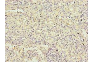 Immunohistochemistry of paraffin-embedded human spleen tissue using ABIN7152485 at dilution of 1:100 (FBXL5 抗体  (AA 1-310))