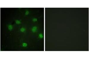 Immunofluorescence analysis of COS7 cells, using TLK1 (Ab-764) Antibody. (TLK1 抗体  (AA 730-779))