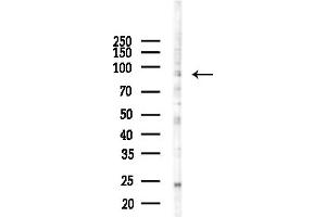 Western blot analysis of lysates from COLO205 cells(UV,30 min treatment), using ESCO1 Antibody at 1/1000 dilution.